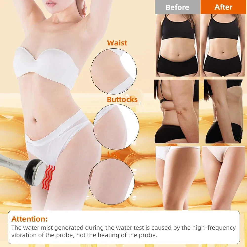 Missheart 4 In 140K Cavitation Ultrasonic Body Slimming Machine Beauty Device Vacuum Suction Facial Massager