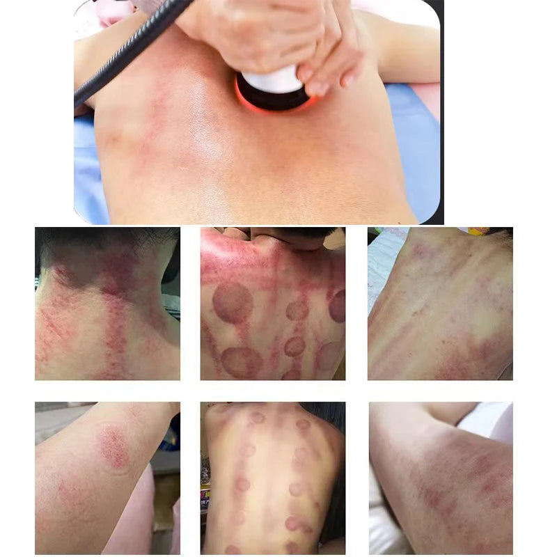 Moonic Beauty 4 In 1 Cavitation Ultrasonic Body Care Tool